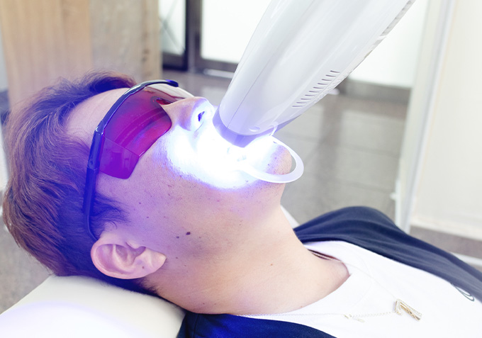 ホワイトニングの施術風景